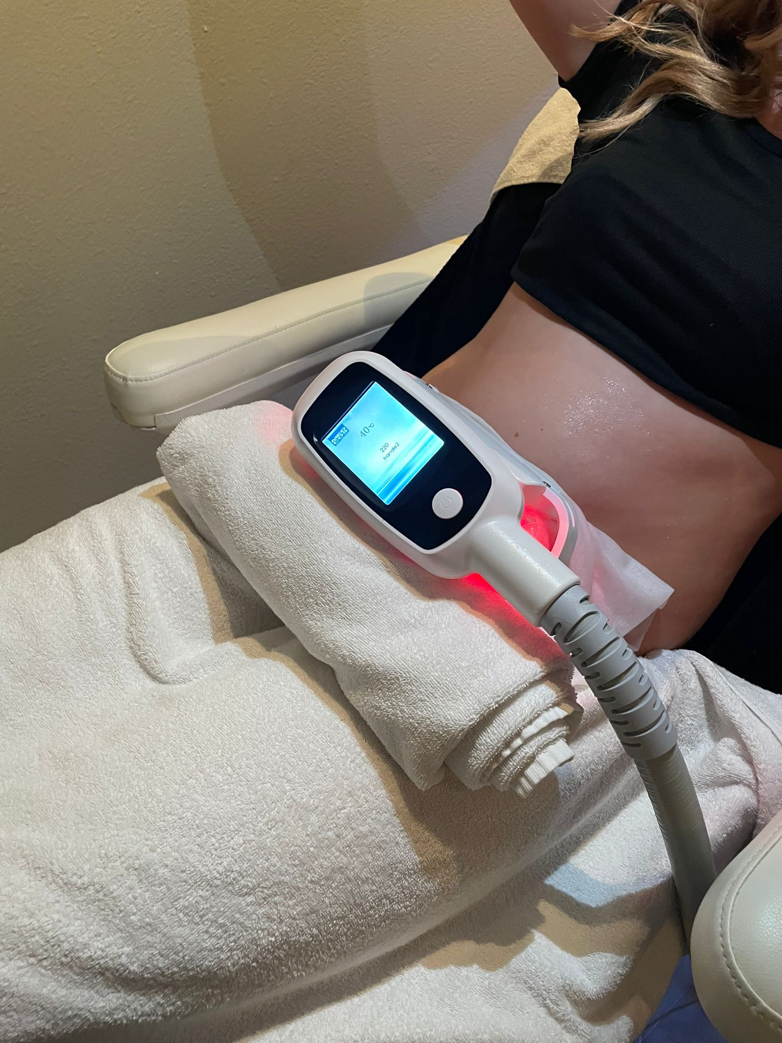Een cryolipolyse-behandeling bij Studio Rosa