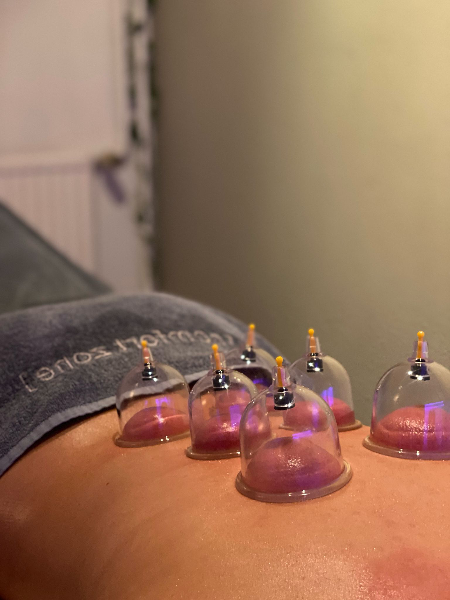 Studio Rosa – Cupping behandeling